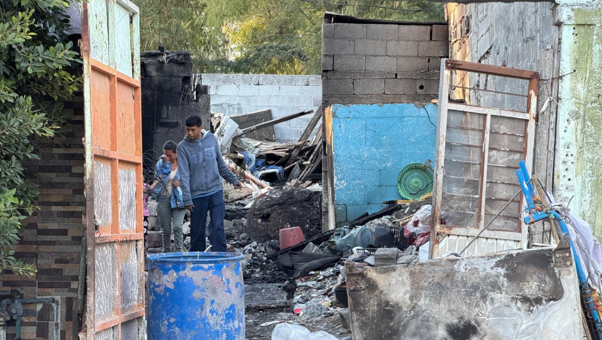Elías Alvarado Delgado resultó con quemaduras. Foto: Mayte Villasana
