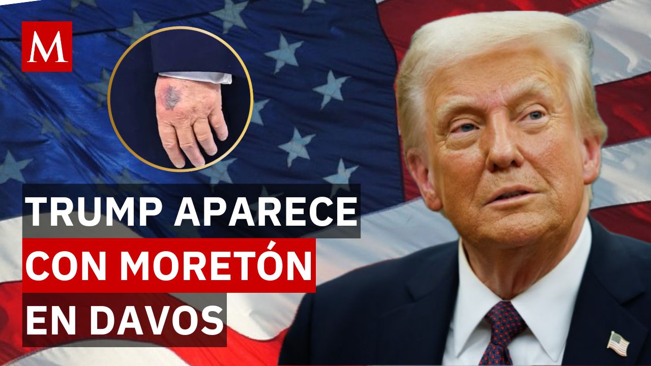 Donald Trump sorprende en Davos al reaparecer con moretones en la mano: esto dijo al respecto