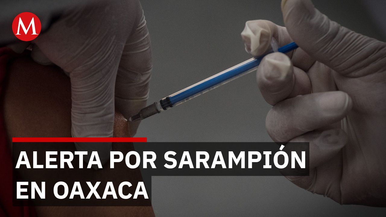 ¿Regresa el sarampión? Confirman tres casos de sarampión en lo que va de 2026 en Oaxaca