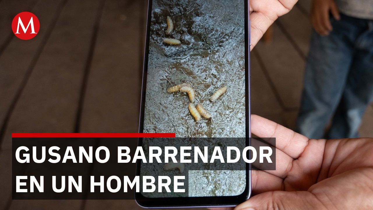 Analizan caso humano con posible gusano barrenador en Copala, Guerrero
