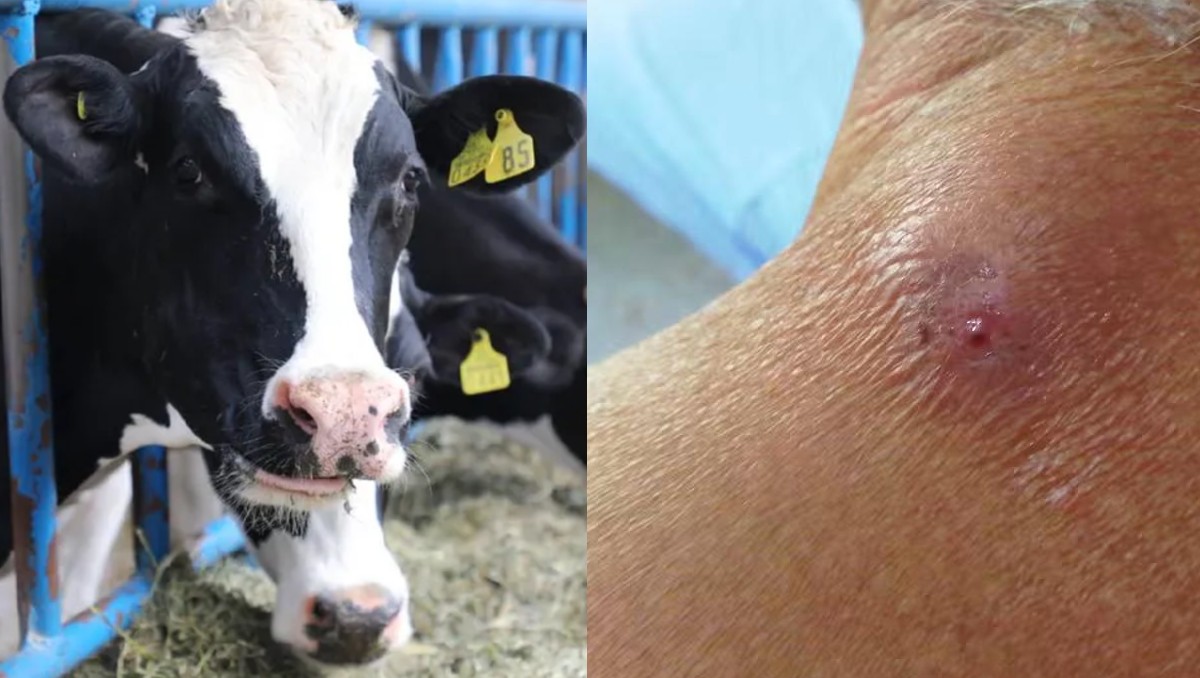 Las heridas en la piel pueden ser factor para la infestación larvaria del gusano barrenador. (Especial)