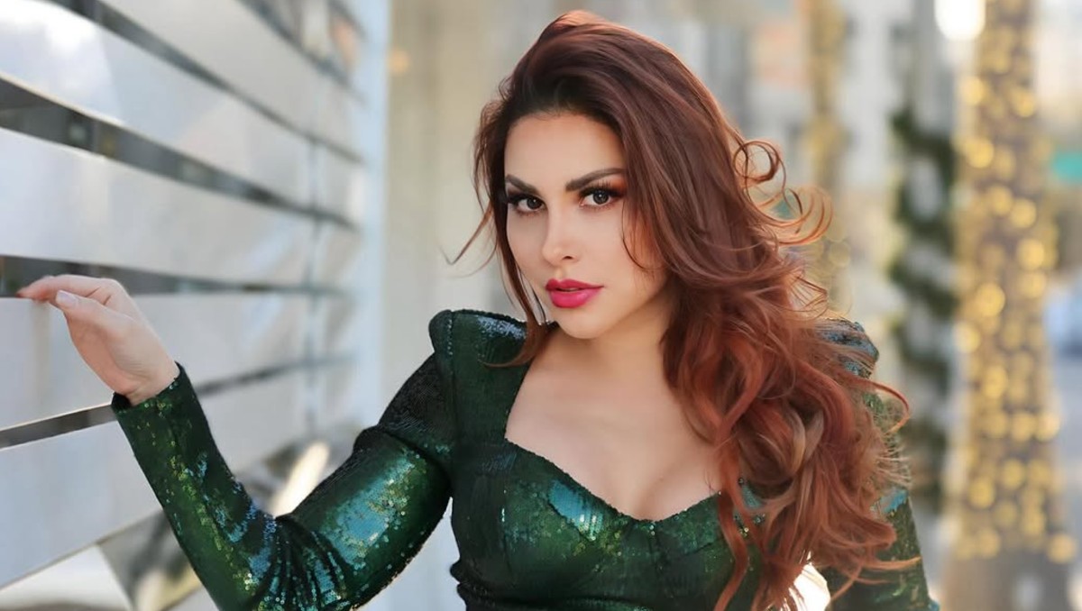 Gaby Ramírez: Perro que la mordió fue sacrificado. | FOTO. Gaby Ramírez