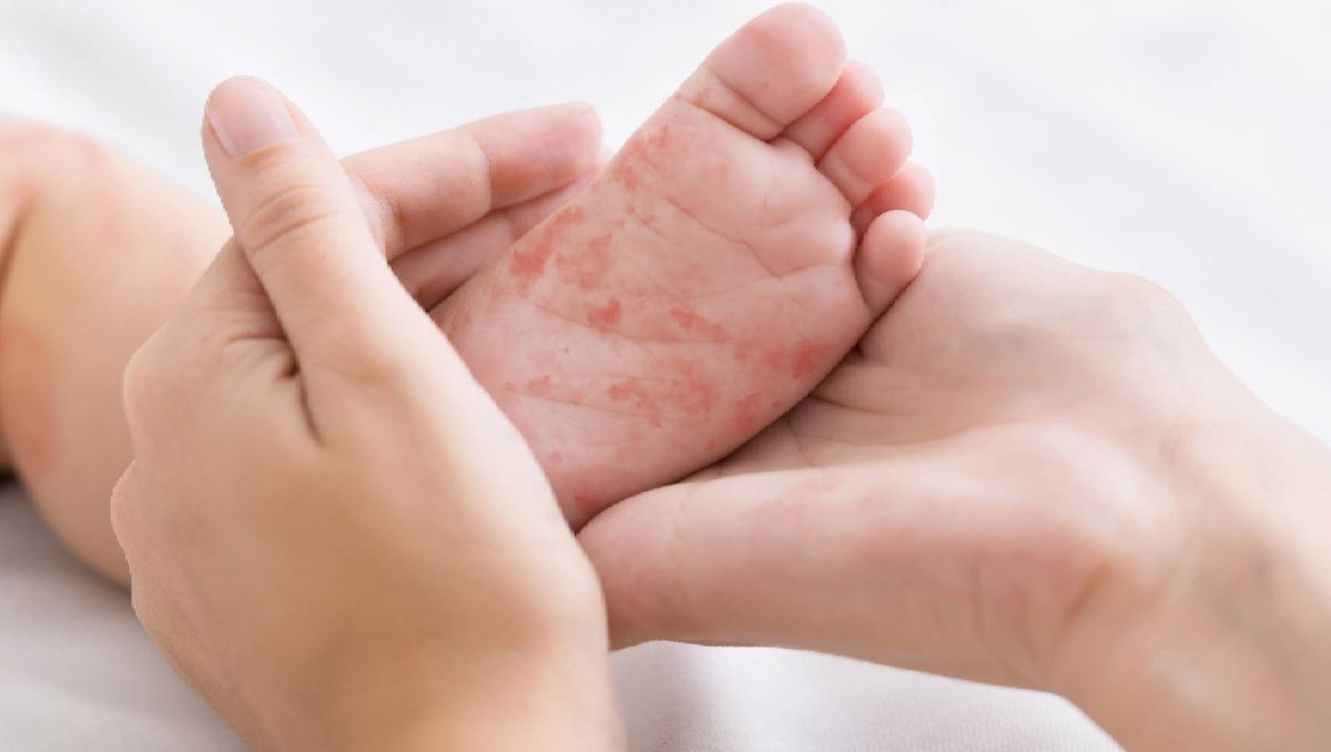 El top 6 de los estados con más casos confirmados lo lidera Chihuahua con 4 mil 500 | Especial