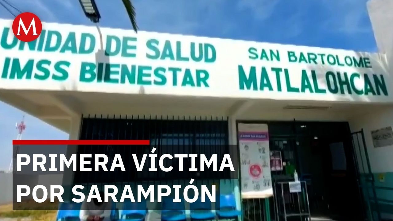 Primera muerte por sarampión en Tlaxcala activa alerta epidemiológica y vacunación