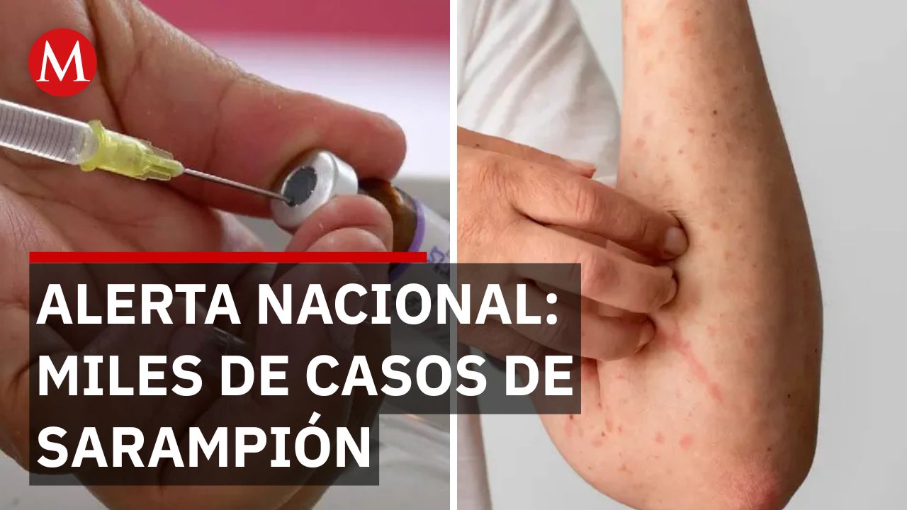 Sarampión en México: Casos aumentan y CDMX lanza vacunación masiva