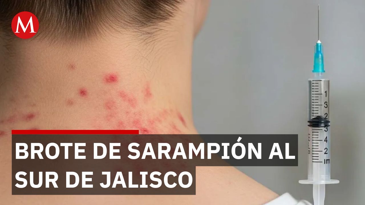 Alerta sanitaria en Jalisco, aplican cerco por contagios de sarampión en el sur
