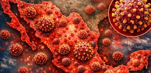 México presenta aumentó de casos de Sarampión | IA Discover