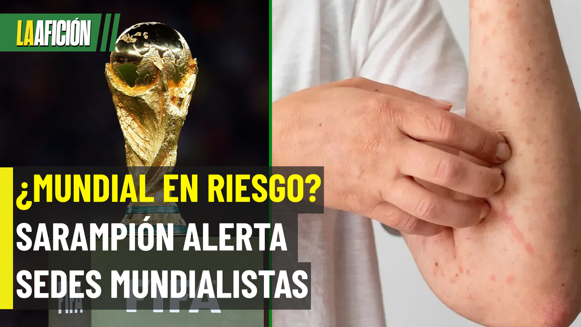 Brote de sarampión en México: ¿Está en riesgo la Copa del Mundo 2026?