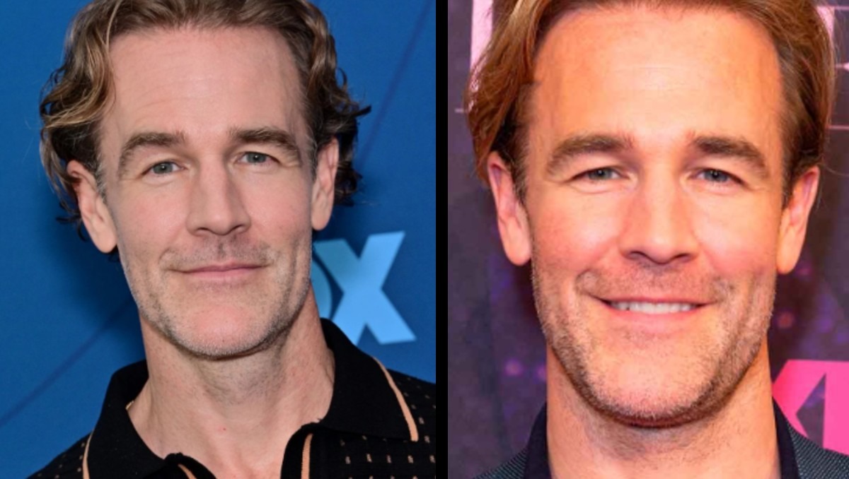 ¿Qué enfermedades tenía James Van Der Beek, actor de la serie Dawson's Creek que murió hoy?