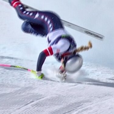 De acuerdo a la agencia AP, la esquiadora Lindsey Vonn volverá a EU, donde será sometida a más cirugías tras su accidente en los Juegos Olímpicos de Invierno.