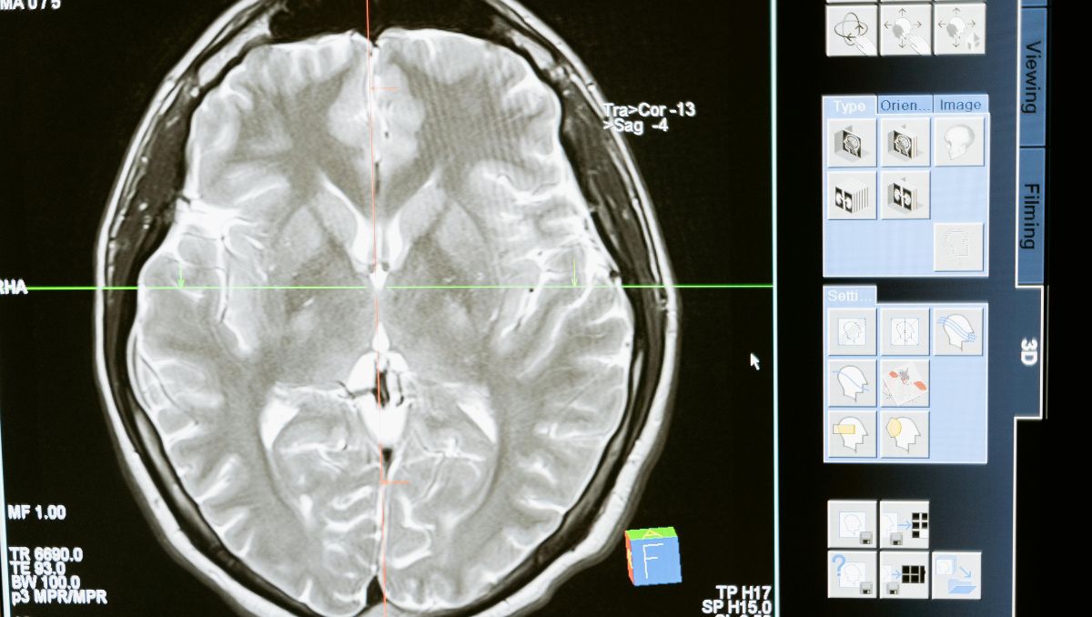 Los científicos han detectado una serie de característica propias de los cerebros longevos  | Especial