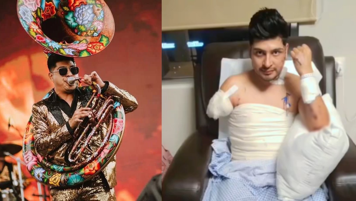 Músico de Memo Garza denuncia falta de apoyo tras accidente.  | FOTO. Andrés Mendoza