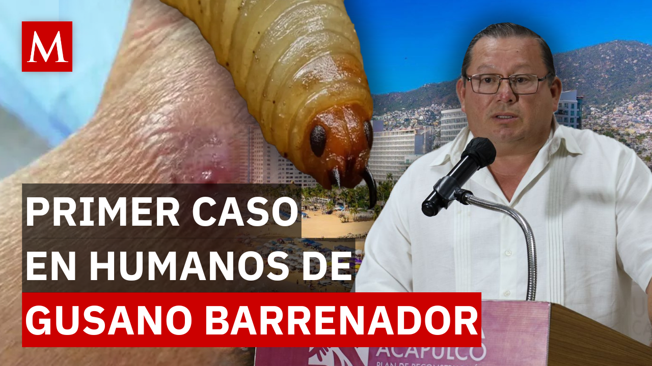 Primer caso de gusano barrenador en humanos enciende alerta sanitaria en Acapulco