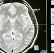 Una de las mayores preguntas que se hacen los científicos es por qué algunos cerebro parecen no envejecer. La ciencia parece haber encontrado algunas explicacio
