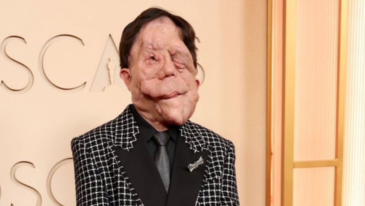 Adam Pearson asistió a los Oscar 2026 | Especial