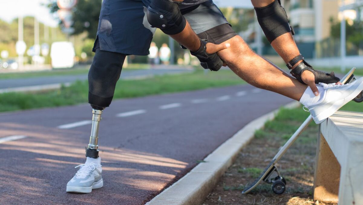 Brazo izquierdo artificial con correas para los hombros. |  Wellcome Collection