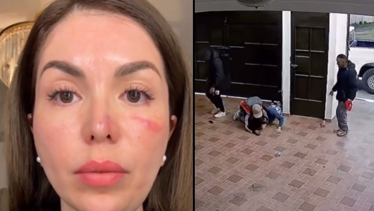 El atraco ocurrió a plena luz del día. | ESPECIAL