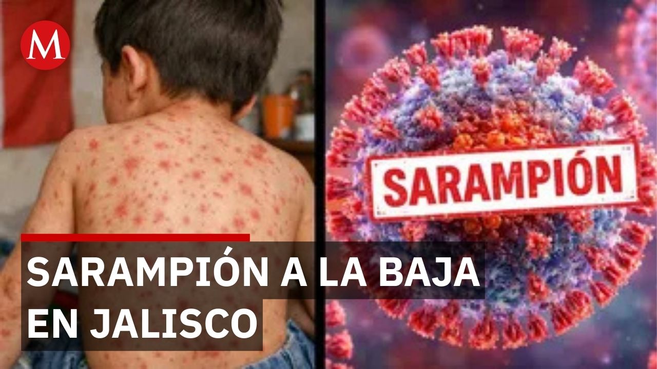 Bajan contagios de sarampión en escuelas de Jalisco