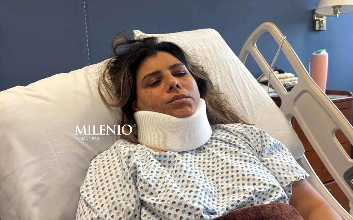 Estefanía Cristel, anfitriona de Airbnb fue golpeada por huéspedes.