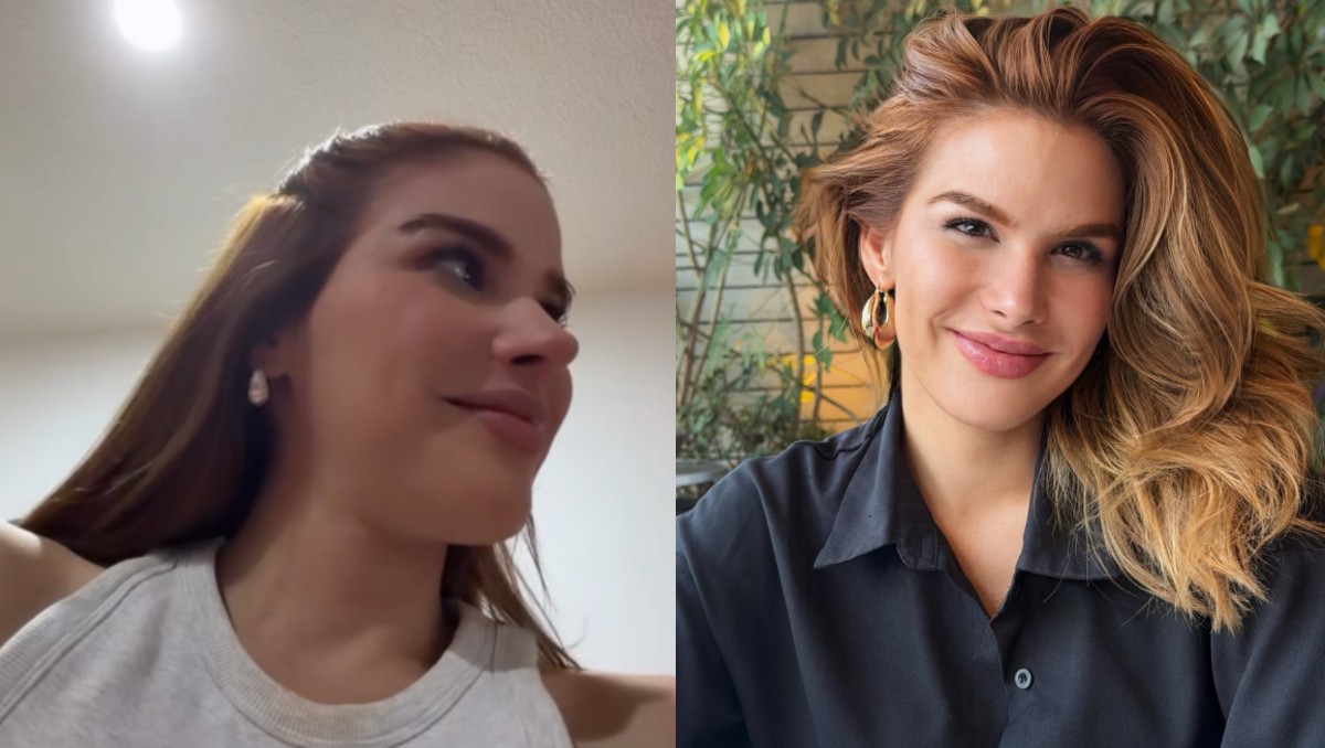 Marie Claire Harp revela cirugía de nariz y así luce tras su transformación. | FOTO: Marie Claire Harp