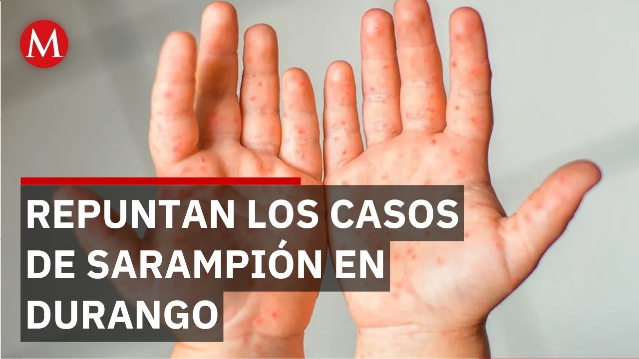 Durango intensifica vacunación ante repunte de sarampión; investigan muertes de niños
