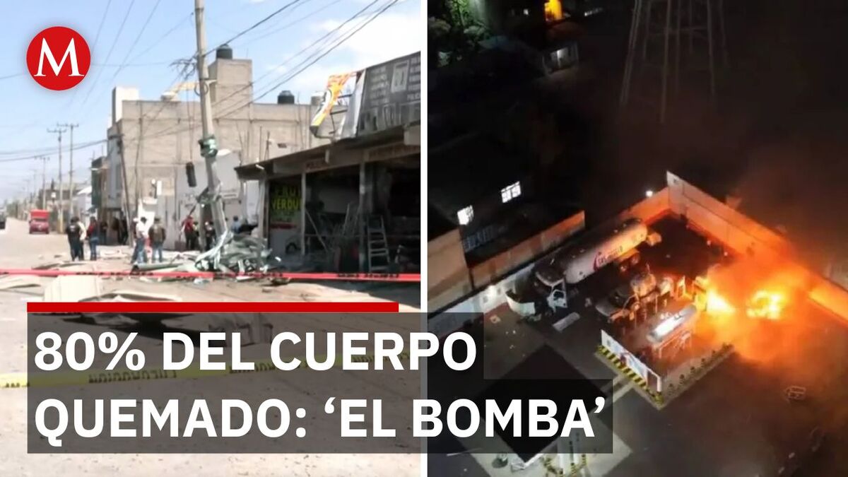 El Bomba' lucha por su vida: El héroe de la explosión en Chalco con 80% de quemaduras