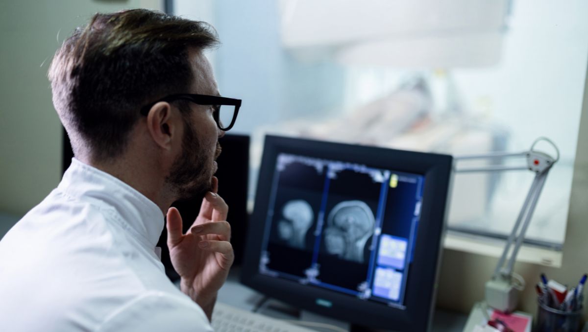 Los microinfartos están asociados al deterioro cognitivo | Especial