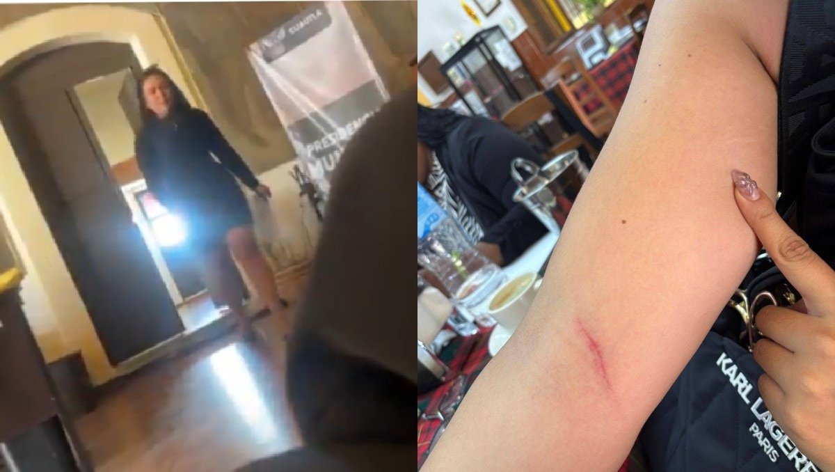 Trabajadora municipal denuncia agresión tras ataque de ex funcionaria en Cuautla. | Especial