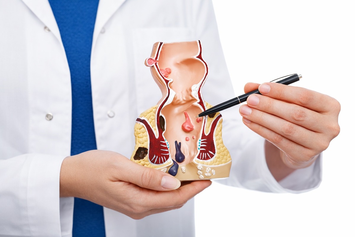 El cáncer colorrectal en México registra diagnósticos tardíos lo que eleva la mortalidad pese a ser prevenible y tratable (Especial)