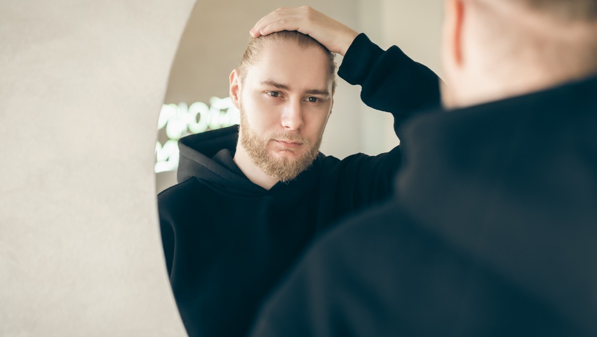 La calvicie suele ser objeto de burla o hasta insulto | Freepik