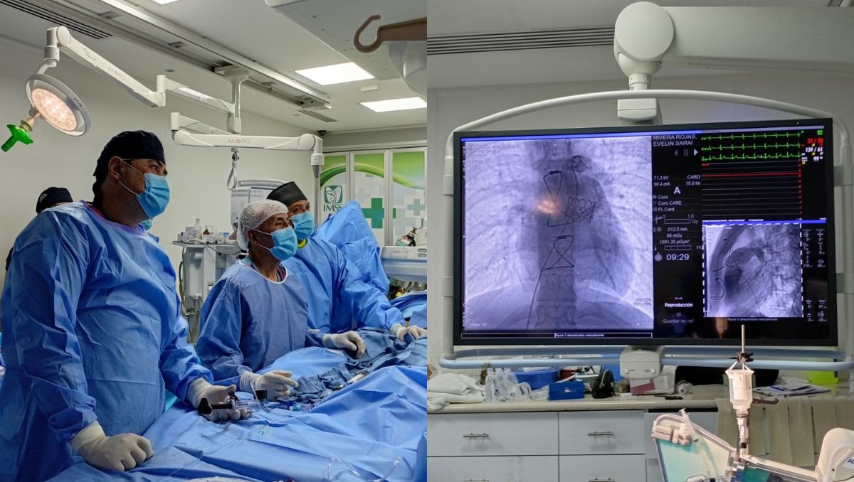 Este procedimiento busca eliminar los riesgos para el paciente que constituye la cirugía a corazón abierto. | Especial