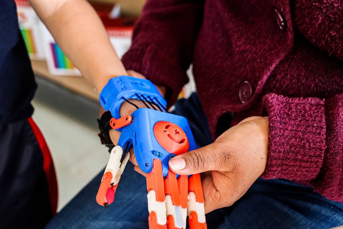 Prótesis 3D gratuitas para menores en Hidalgo