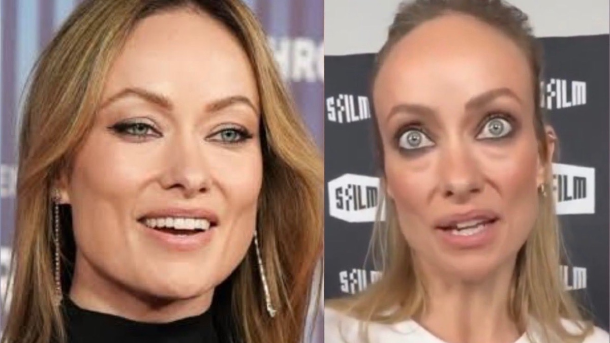 Médico analiza el rostro de Olivia Wilde y habla del “Ozempic face”