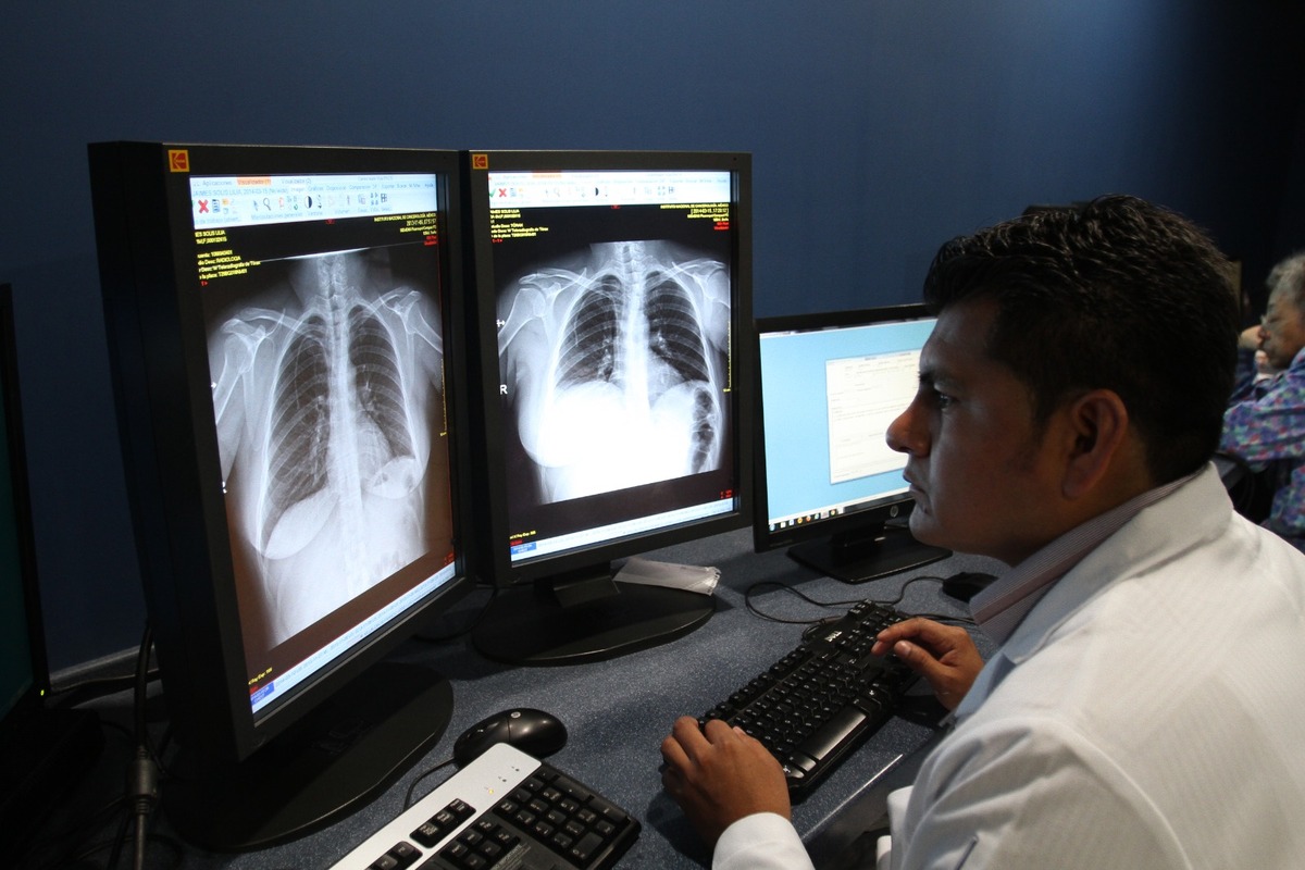 Elena fue sometida a dos cirugías pulmonares en 2024 y a quimioterapia prolongada. (Foto: Héctor Tellez)