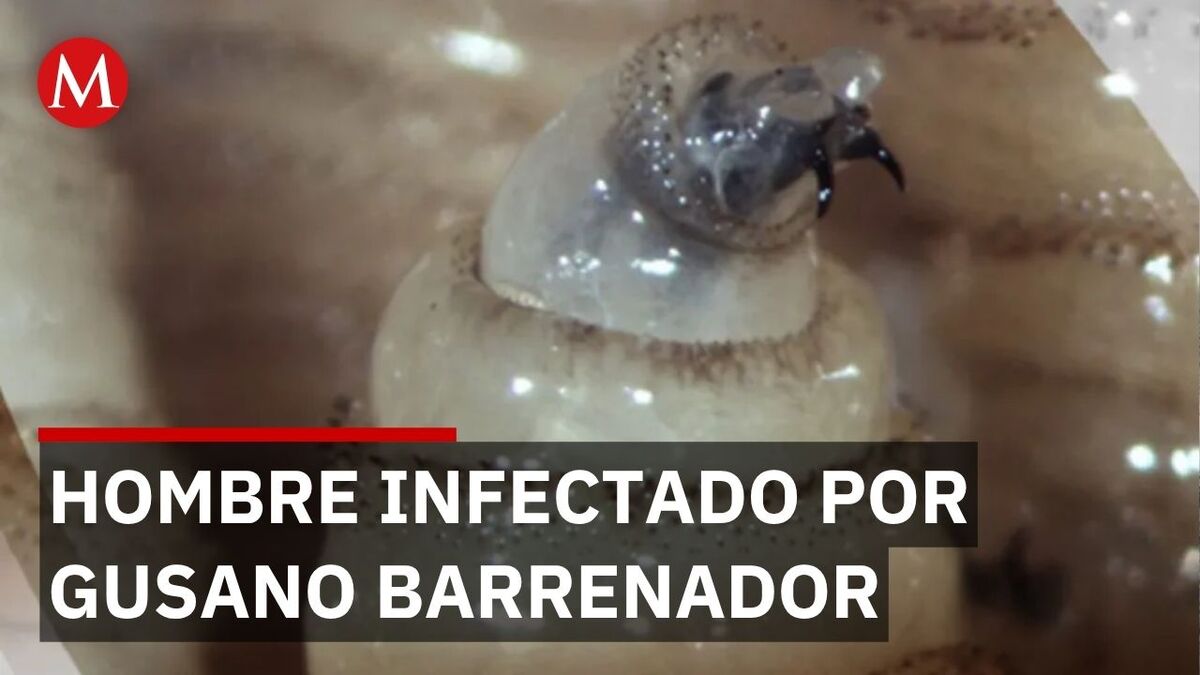 El gusano barrenador se extiende: detectan primer caso en una persona en Querétaro