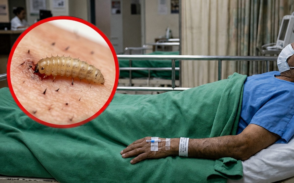 Paciente con miasis por gusano barrenador en Tamaulipas ya fue dado de alta, informa Salud