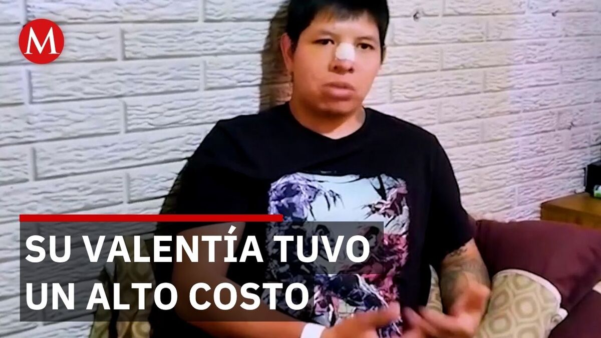 Trabajador del AICM termina hospitalizado por defender a estudiantes en el Metro La Raza