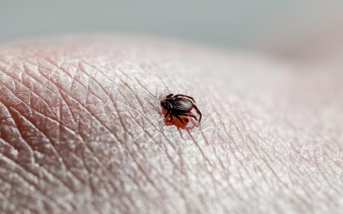 La enfermedad de las garrapatas: rickettsia