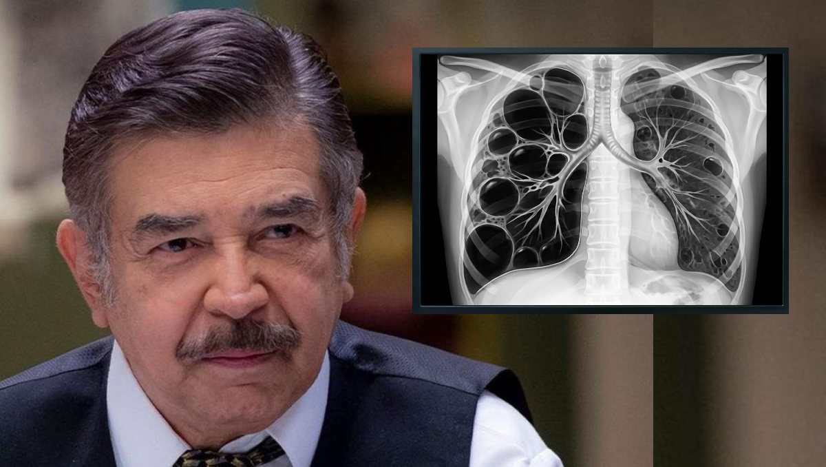 Jorge Ortiz de Pinedo: ¿Qué enfermedades tiene el actor? | ESPECIAL