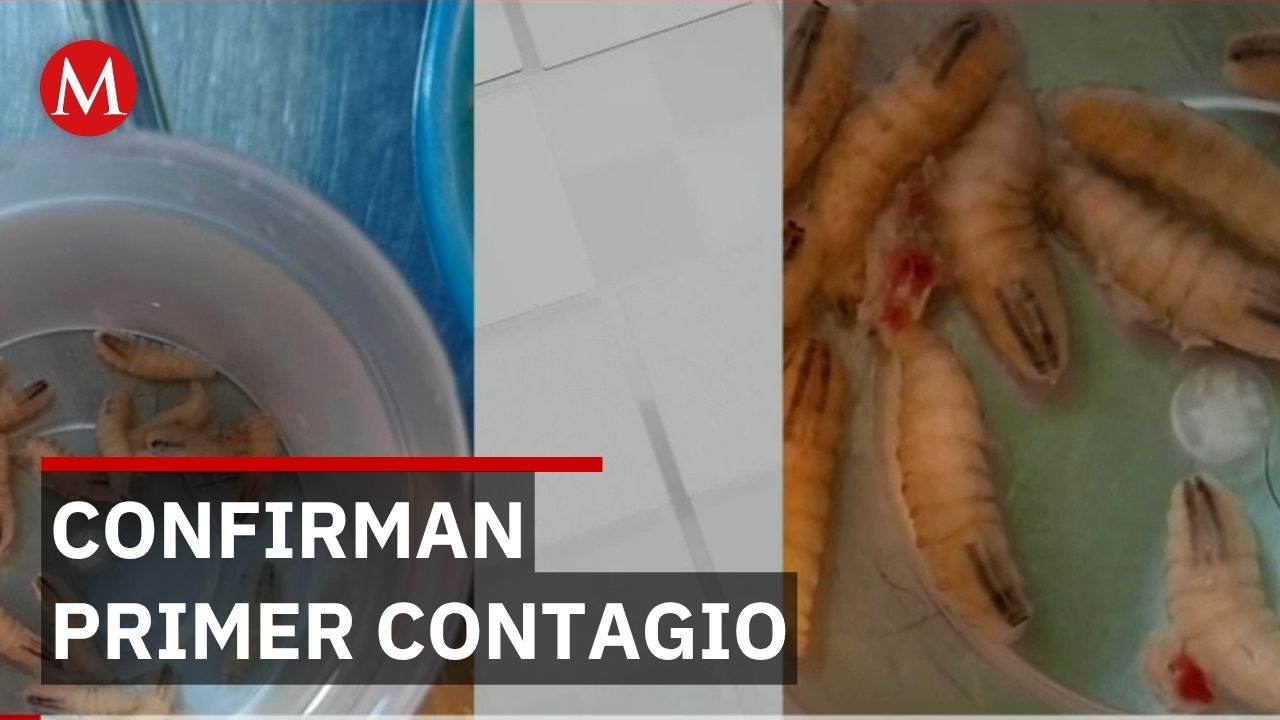 Secretaría de Salud confirma primer caso de gusano en persona en la CdMx