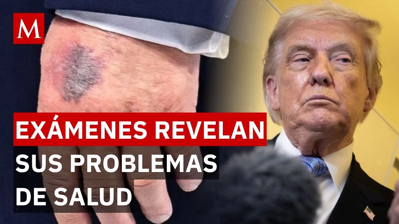 ¡Alerta en la Casa Blanca! Trump presume "inteligencia extrema" y revela su estado de salud actual