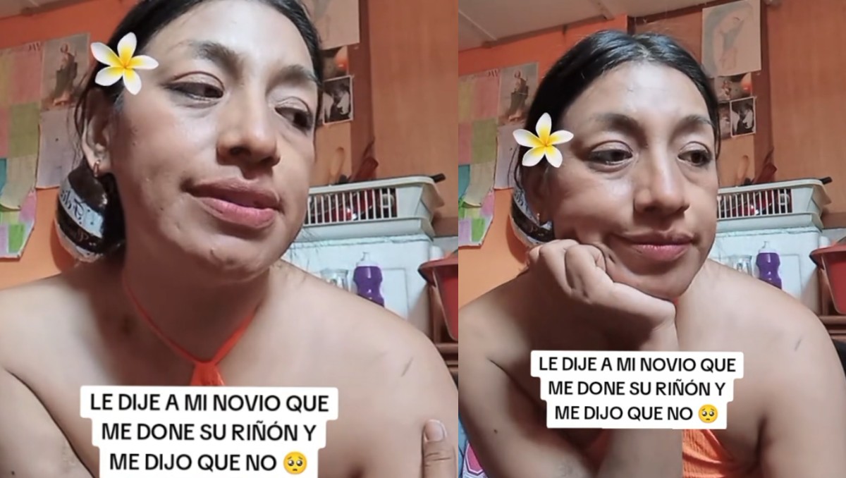 Mujer en diálisis recordó la respuesta de su novio ante una posible donación de riñón y recibe críticas. | FOTO: TikTok @jennylaguerreraof