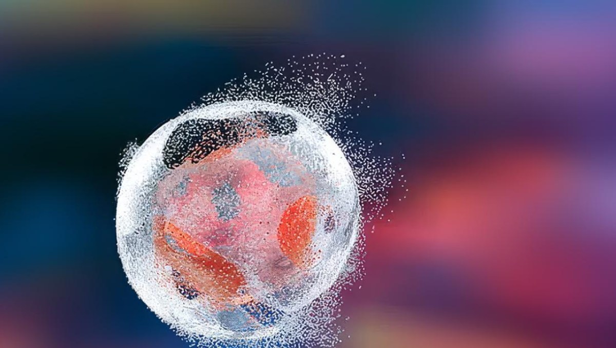 Estudio revela que quimioterapia puede generar resistencia en el cáncer (Foto: Shutterstock)