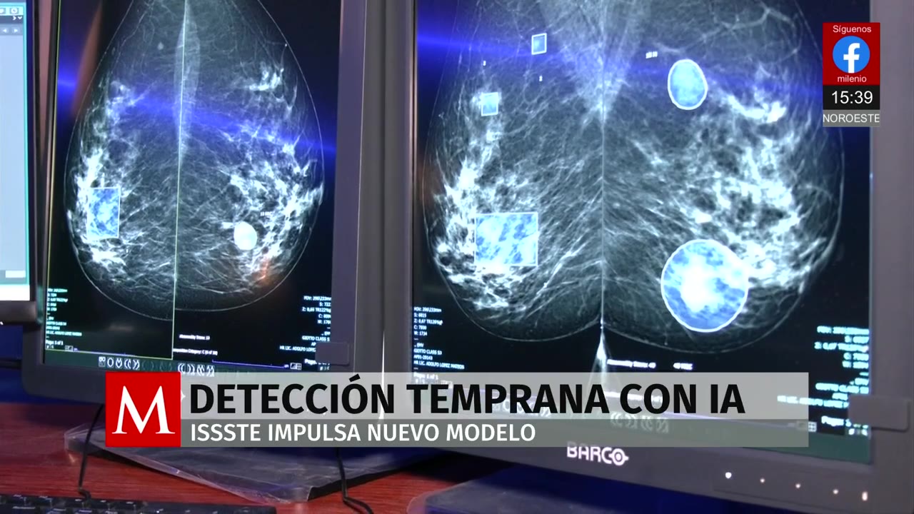 IA detecta tumores menores a 2 milímetros impalpables para diagnóstico temprano de cáncer