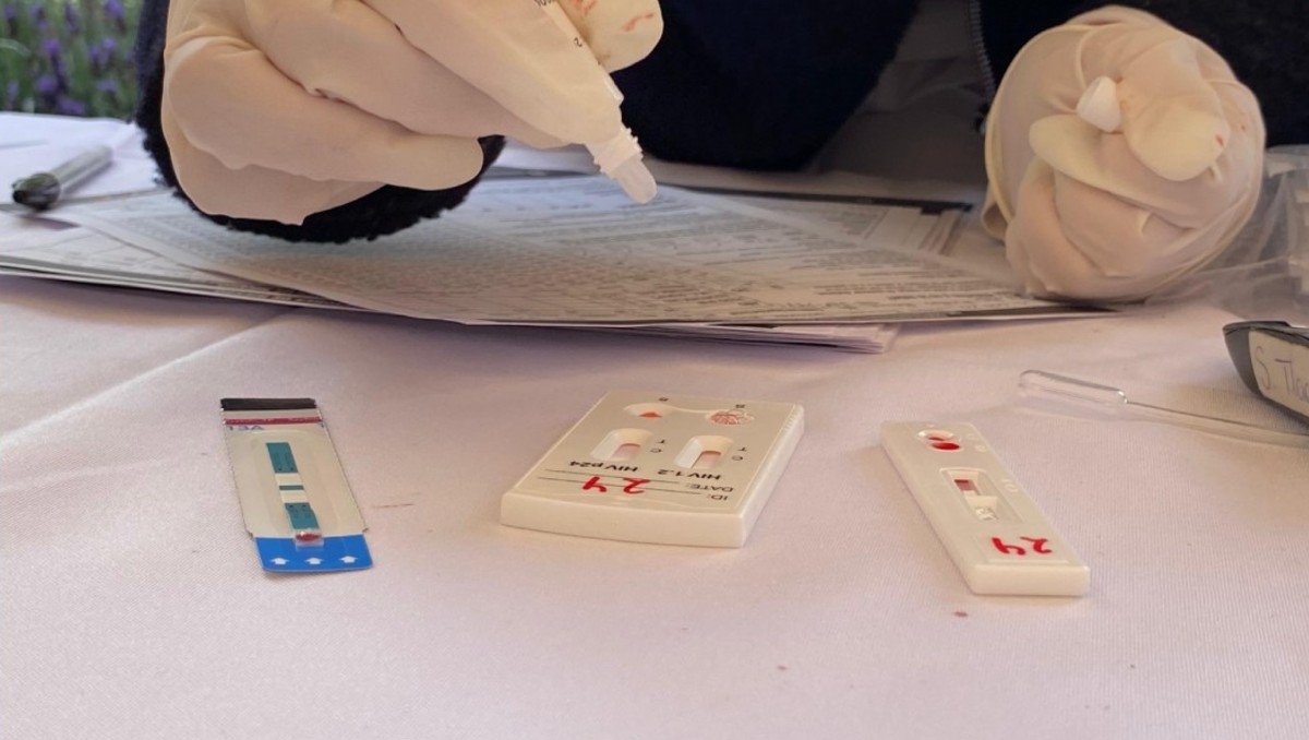 Con las pruebas de VIH han detectado hasta mil casos por año | Archivo