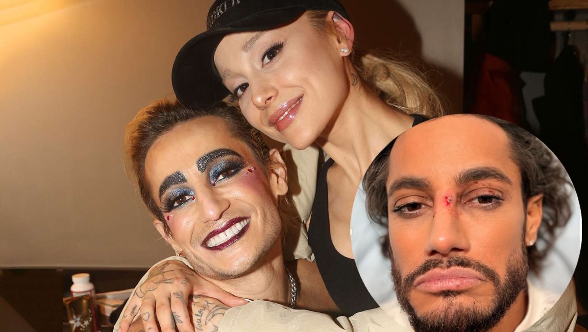 Frankie Grande sufre fuerte golpe en el rostro y conmoción cerebral en pleno show (Foto: Redes sociales)