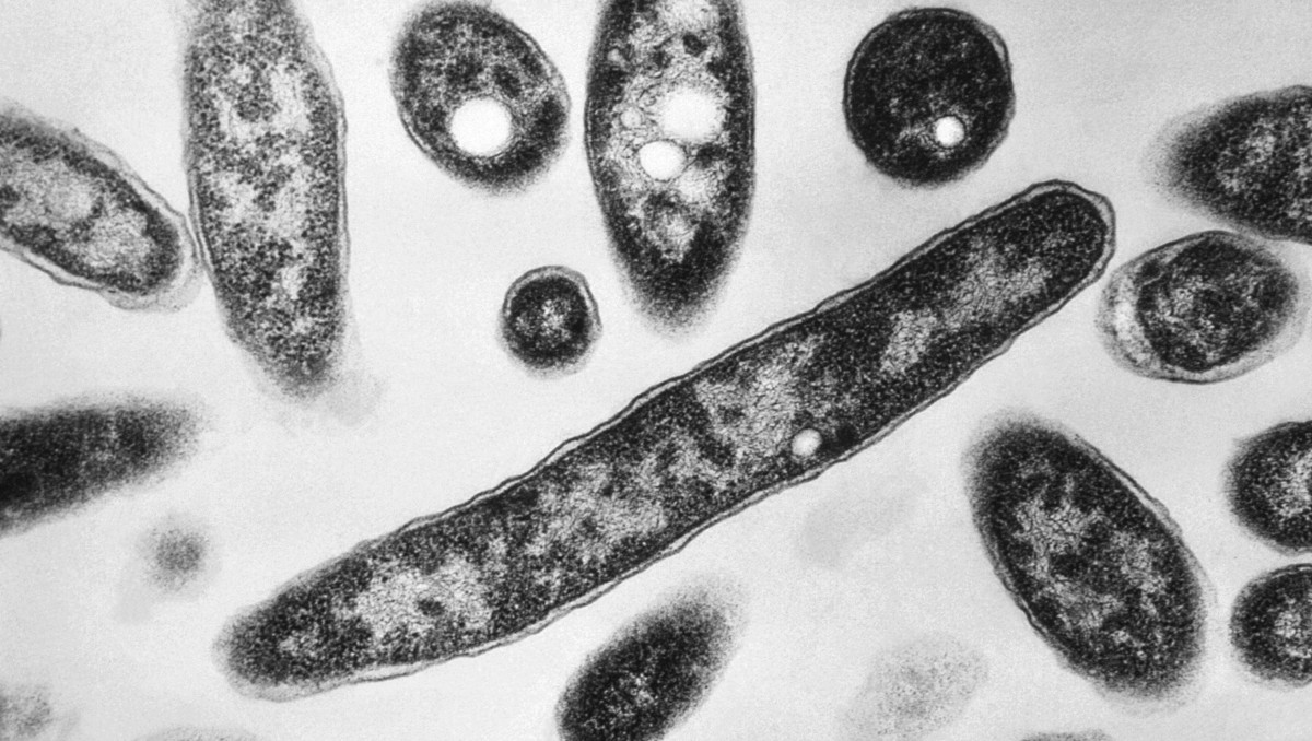 Imagen de microscopio tomada en 1978, entregada por los Centros de Control y Prevención de Enfermedades de EU que muestra la bacteria. | AP