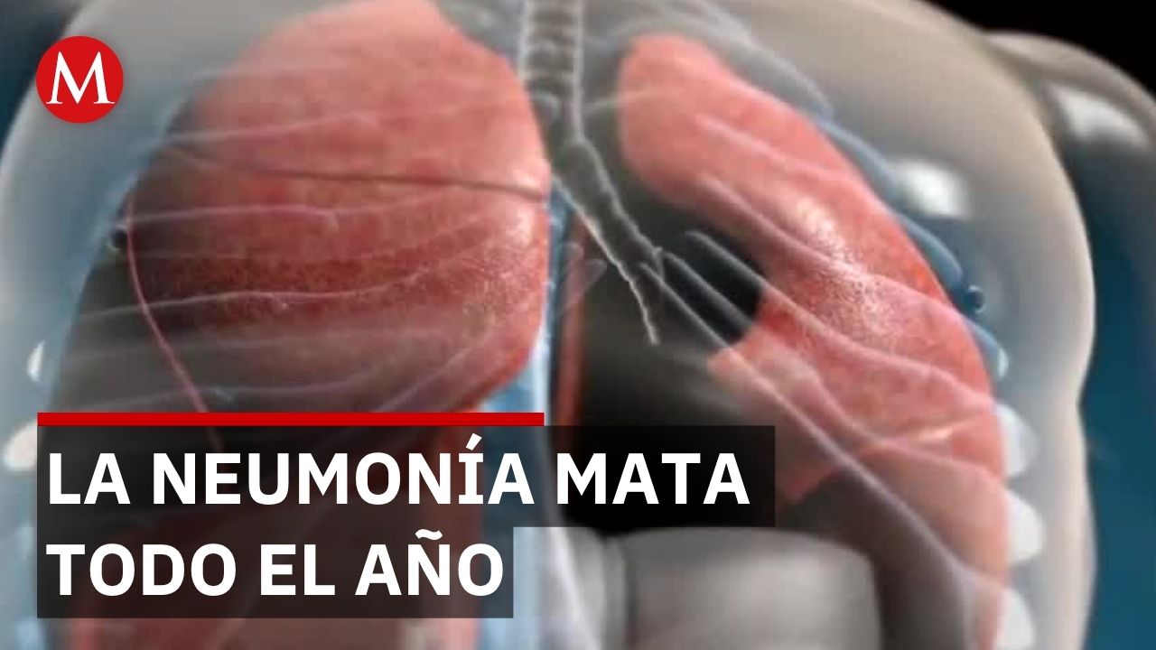 Neumonía afecta todo el año pero mito de invierno cuesta vidas a adultos mayores