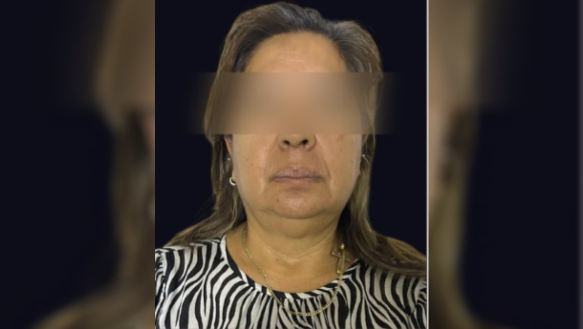 A la víctima le tuvieron que amputar la pierna para salvarle la vida. | Especial