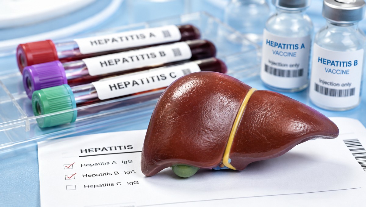 Diferencias entre hepatitis A, B y C: cómo se contagian | IA DISCOVER